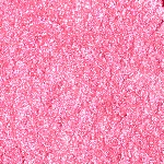 HL01 Fever Garnet - Format voyage